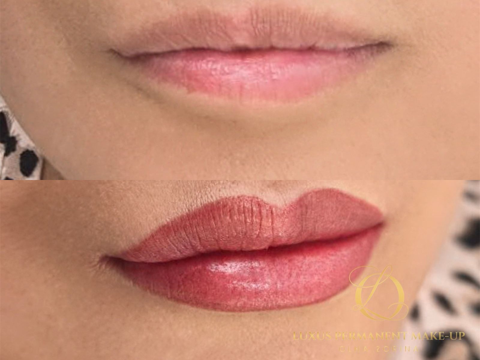 Vorher-Nachher: Lip Blush im Profil