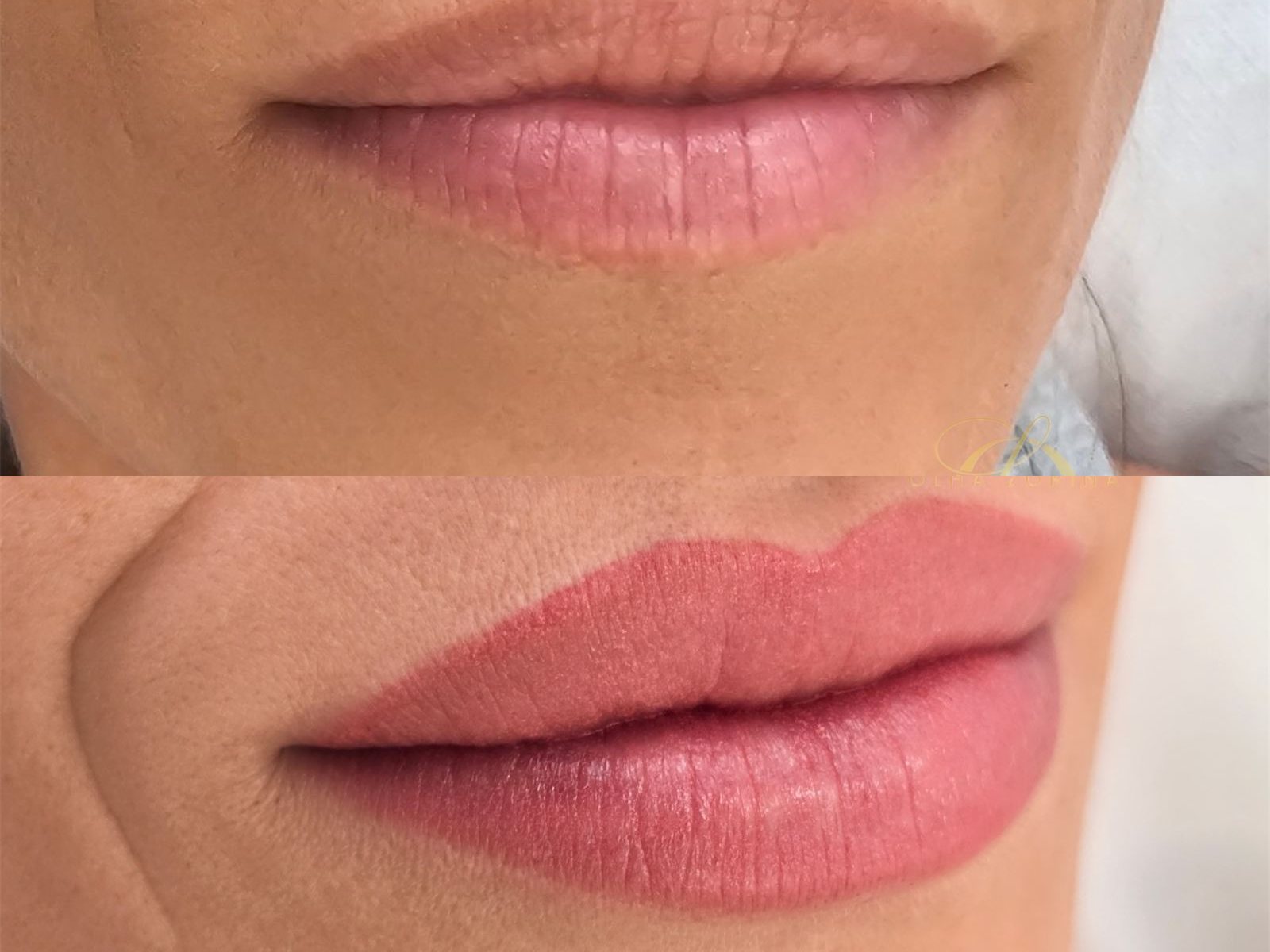 Vorher-Nachher: Lip Blush bei reifen Lippen