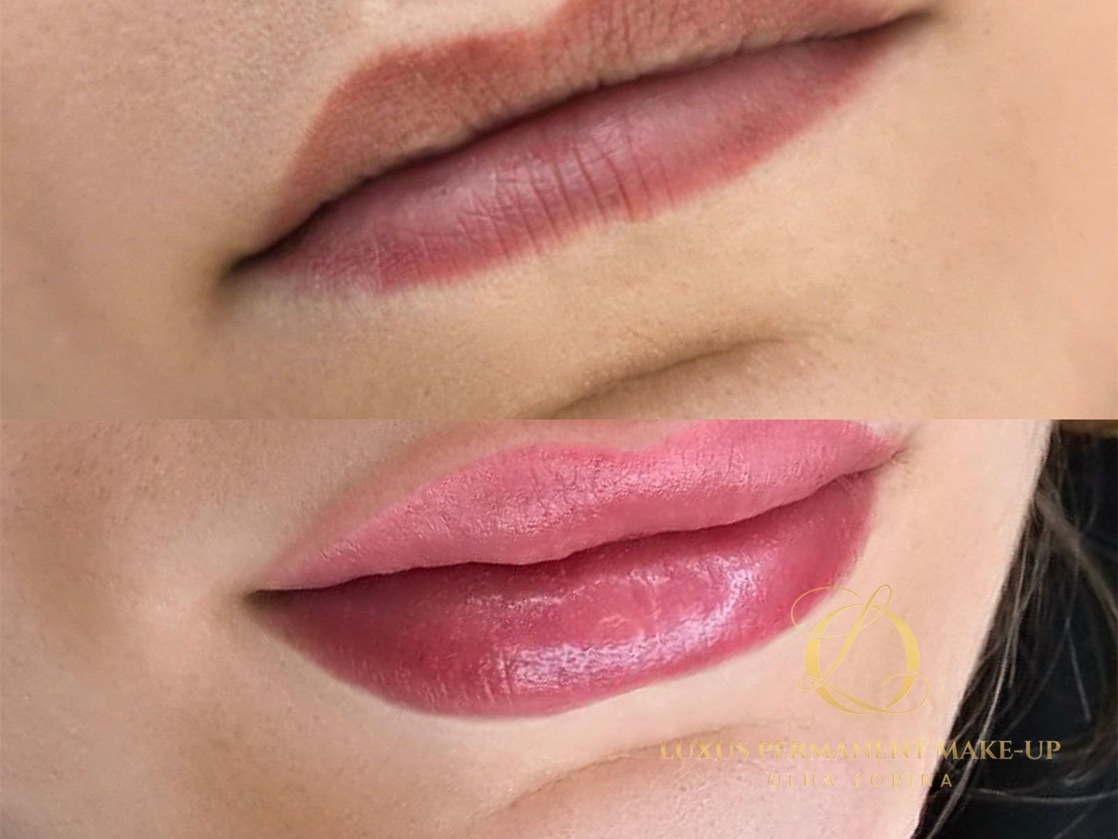 Vorher-Nachher: Auffrischung einer dunklen Lippenkontur