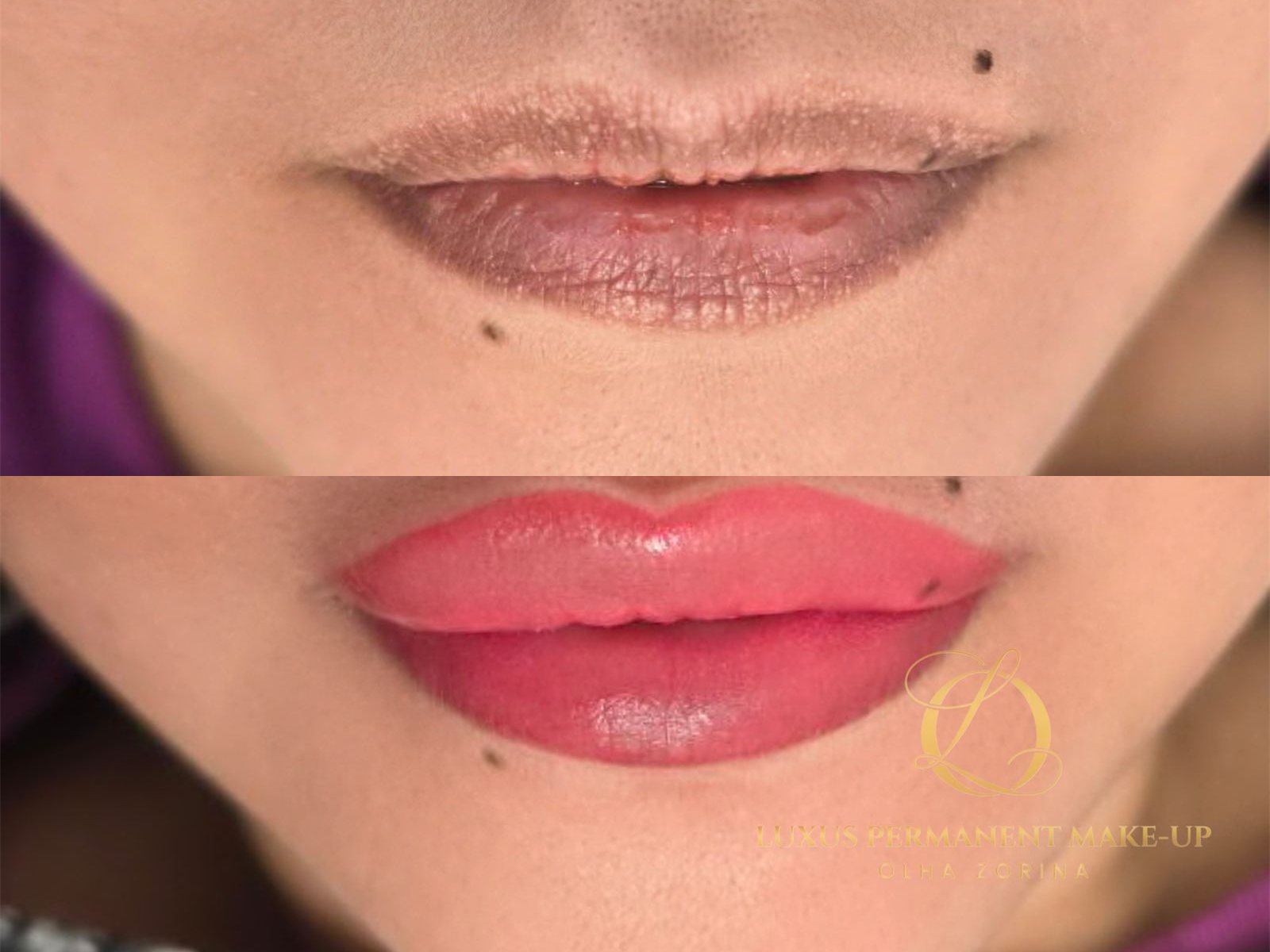 Vorher-Nachher: Lippen-Pigmentierung mit kräftiger Farbtransformation