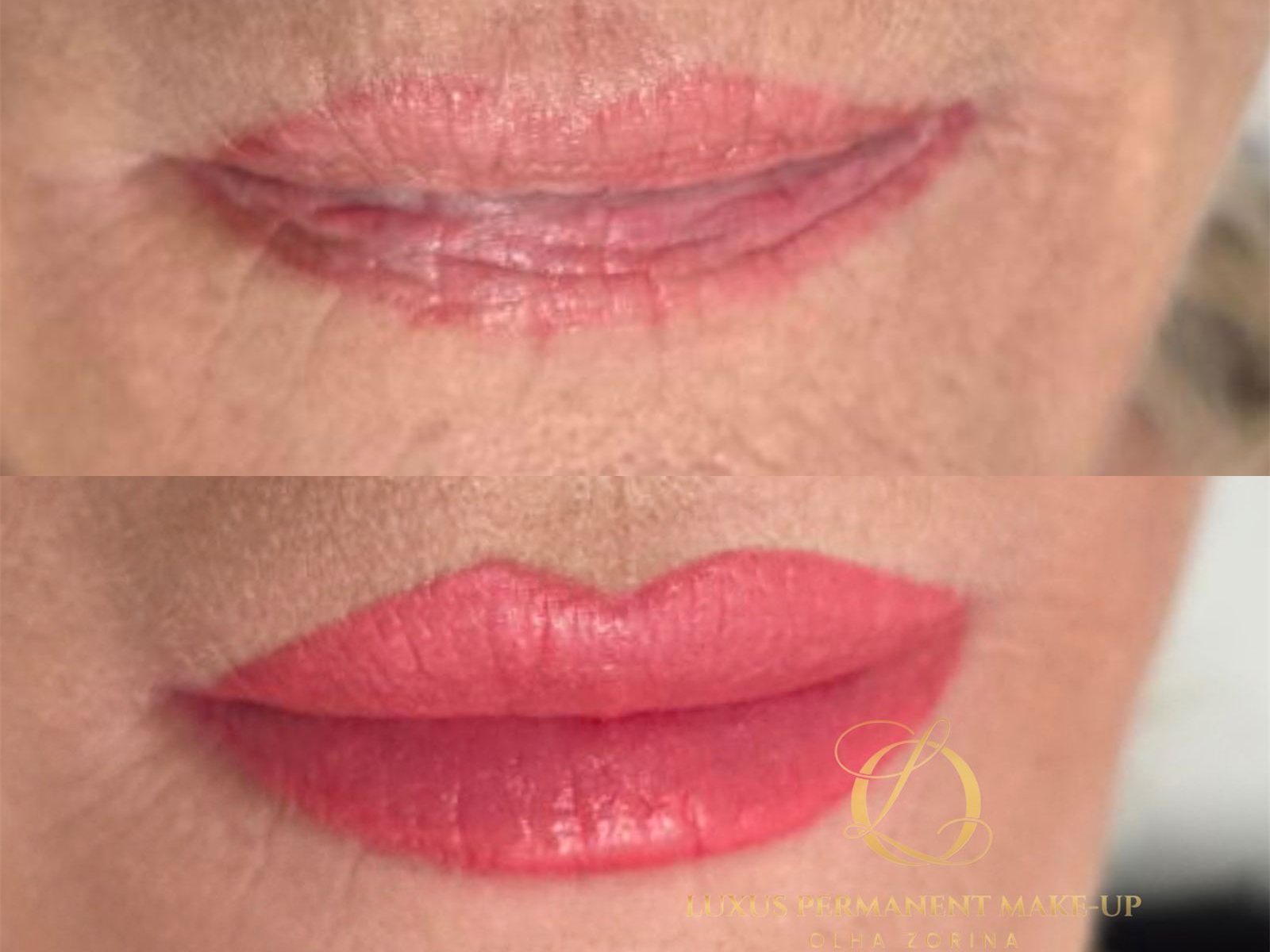 Vorher-Nachher: rote Pigmentreste außerhalb der Lippenkontur neutralisiert