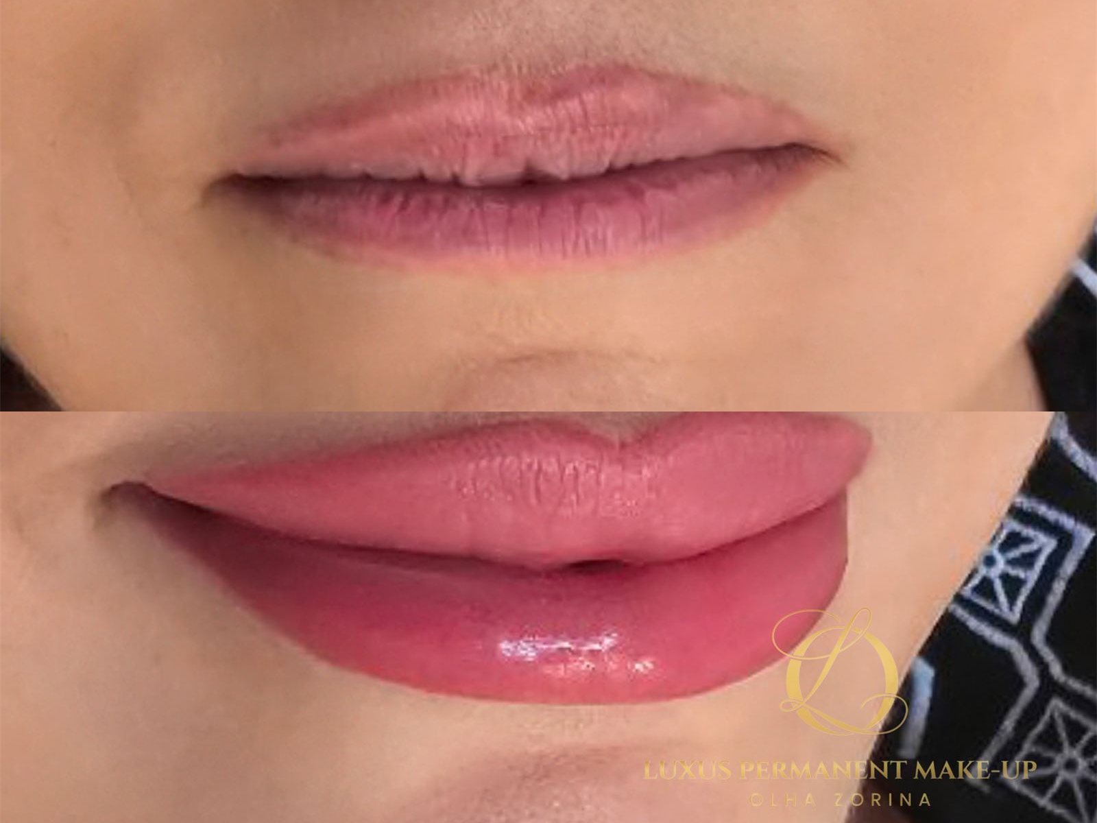 Vorher-Nachher: blasse, ungleichmäßige Lippenpigmentierung zu vollem Rosa korrigiert