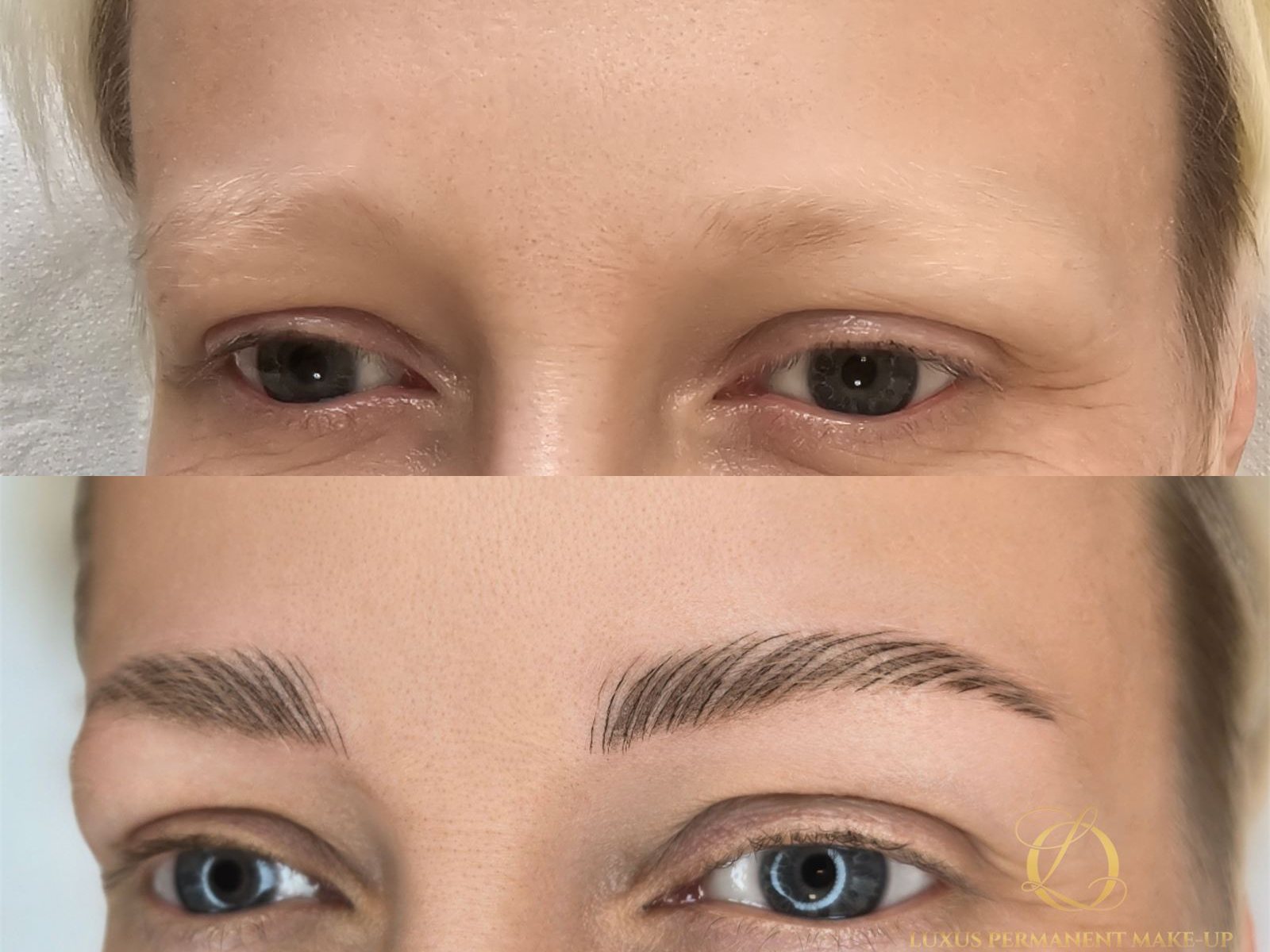 Vorher-Nachher: natürlicher Augenbrauen-Aufbau bei Alopezie