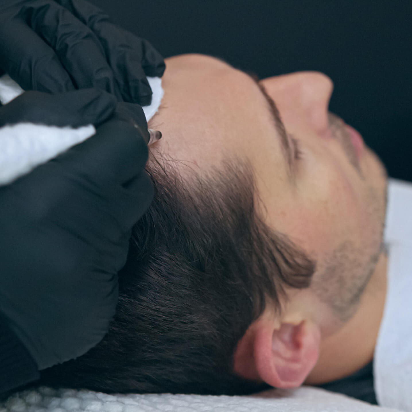 Paramedizinische Pigmentierung