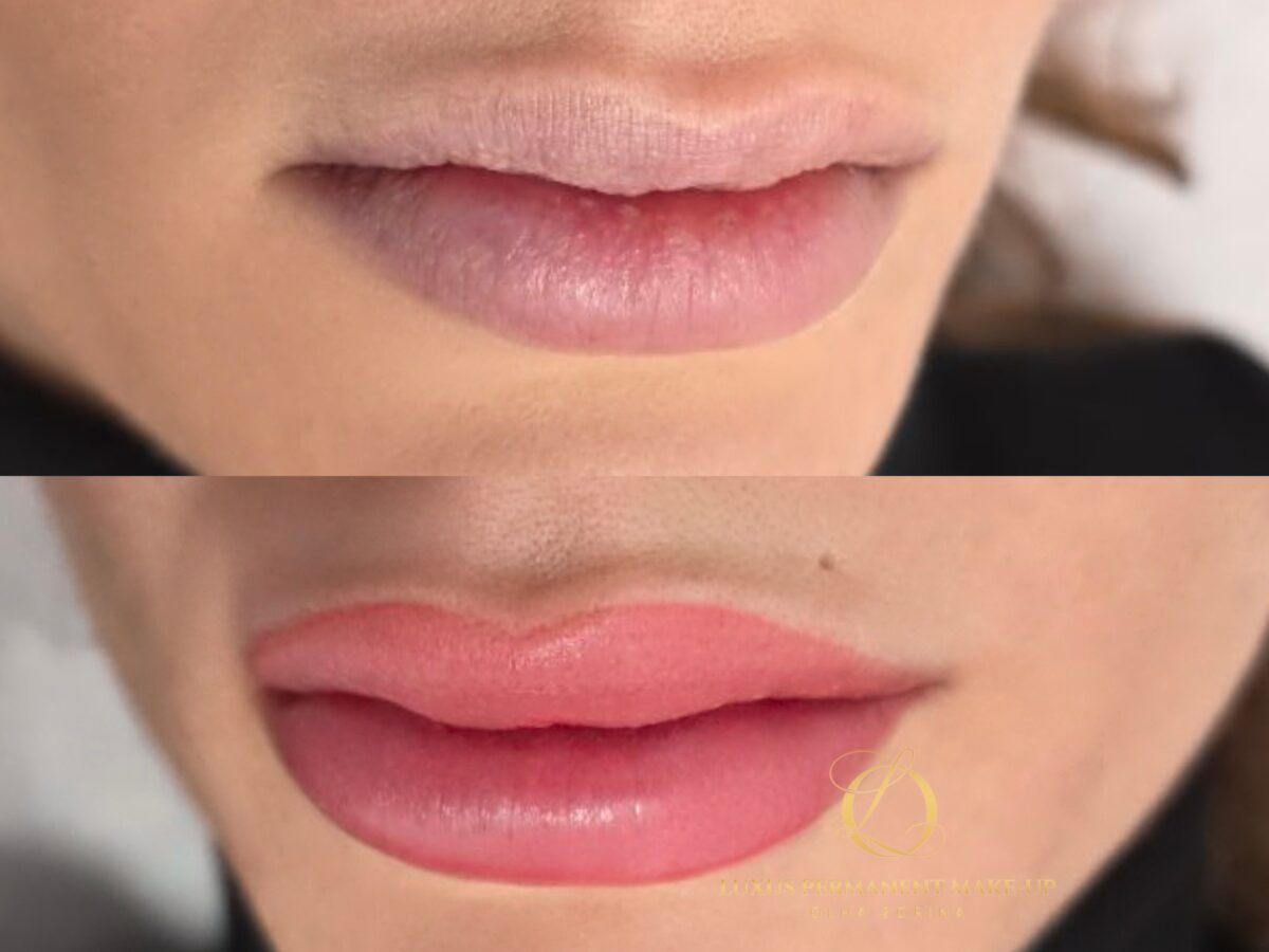 Vorher-Nachher: Lip Blush mit natürlicher Rosé-Nuance