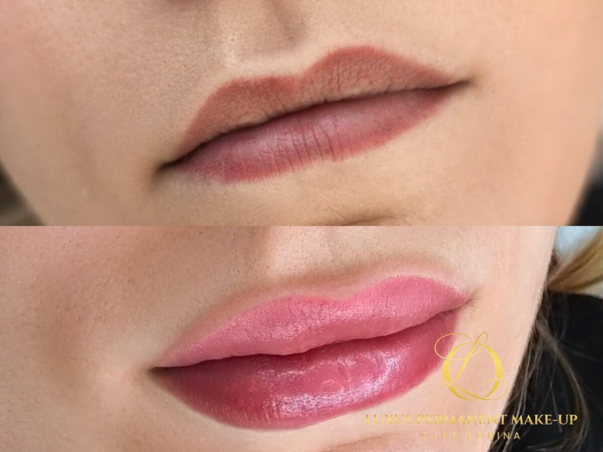 Vorher-Nachher: Auffrischung einer dunklen Lippenkontur