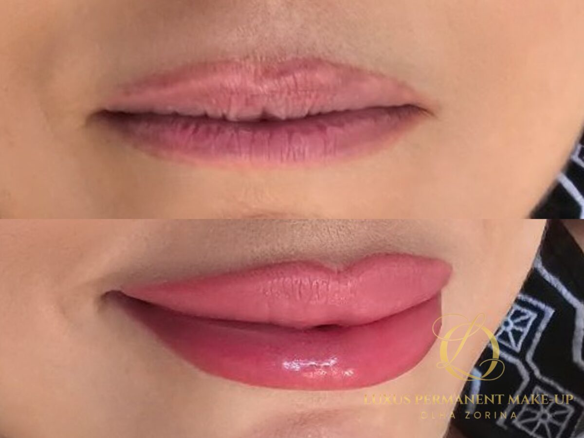 Vorher-Nachher: blasse Lippenpigmentierung einer Fremdarbeit zu vollem Rosa korrigiert